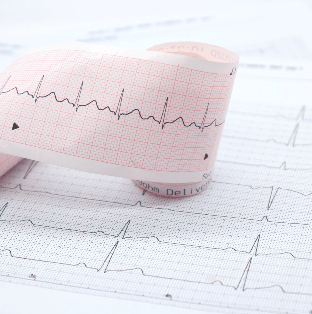 EKG electrodes placed on a patient's chest for heart rhythm testing at Elon Health Urgent Care in Davenport, FL