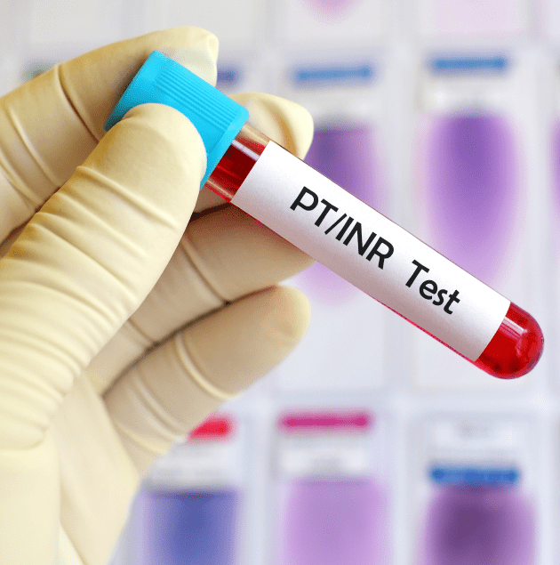 Finger-stick blood sample being taken for a PT and INR check at Elon Health Urgent Care in Davenport, FL